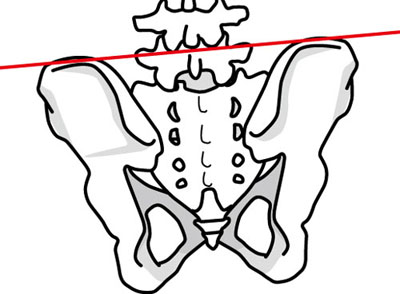 骨盤の傾き