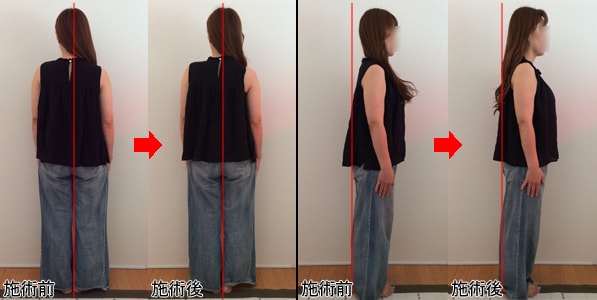 I.Yさんの施術前後写真